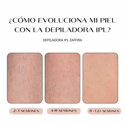 Depiladora IPL + depiladora facial de regalo